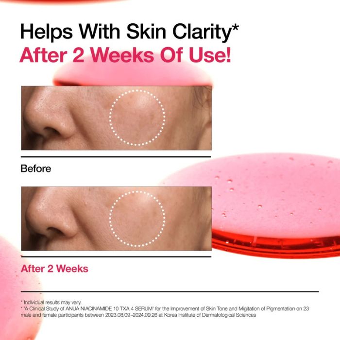 Niacinamide 10% + TXA 4% Serum – Ορός λάμψης για σκούρες κηλίδες, 30ml