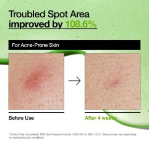 Azelaic Acid 10 Hyaluron Redness Soothing Serum – Καταπραϋντικός Ορός, 30ml