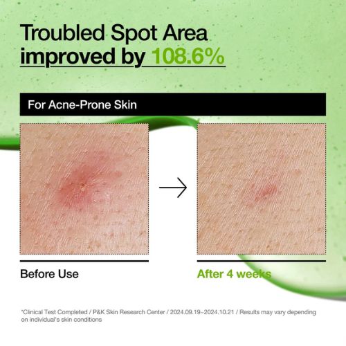 Azelaic Acid 10 Hyaluron Redness Soothing Serum – Καταπραϋντικός Ορός, 30ml
