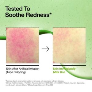 Azelaic Acid 10 Hyaluron Redness Soothing Serum – Καταπραϋντικός Ορός, 30ml