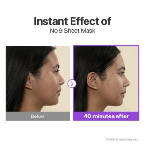 No. 9 NAD+ BIO Lifting-sil Full Face Mask Set, 4 pieces – Μάσκα προσώπου lifting και λάμψης, 4τεμ