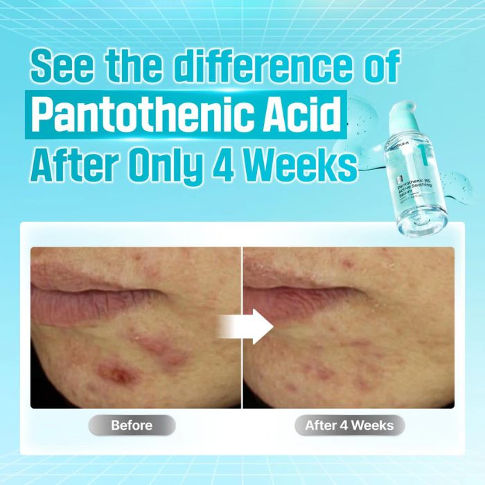 No.1 Pantothenic B5 Active Soothing Serum – Ενυδατικός και καταπραϋντικός ορός, 50ml