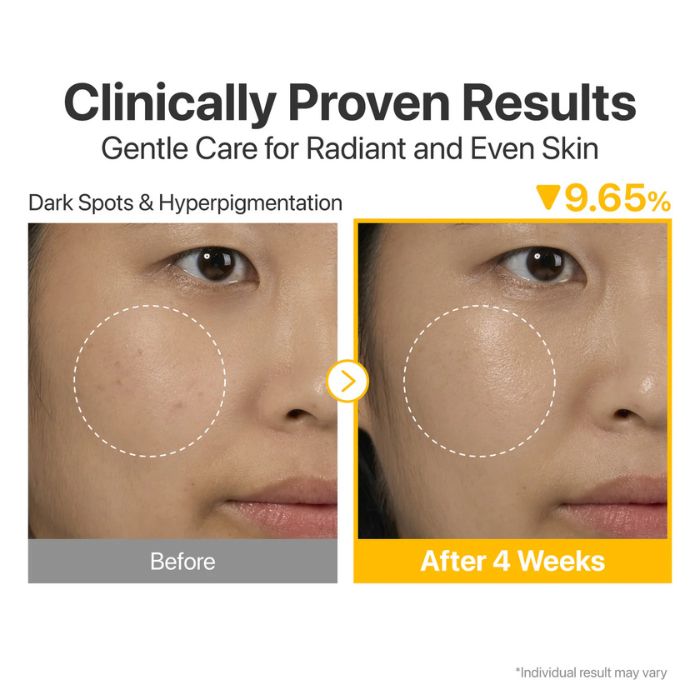 No.5 Vitamin Concentrated Serum – Αντιοξειδωτικός ορός Βιταμίνης C 30ml