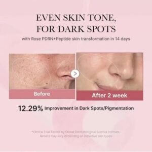 PDRN Pink Cica Soothing Toner – Καταπραϋντικό τόνερ προσώπου, 250ml