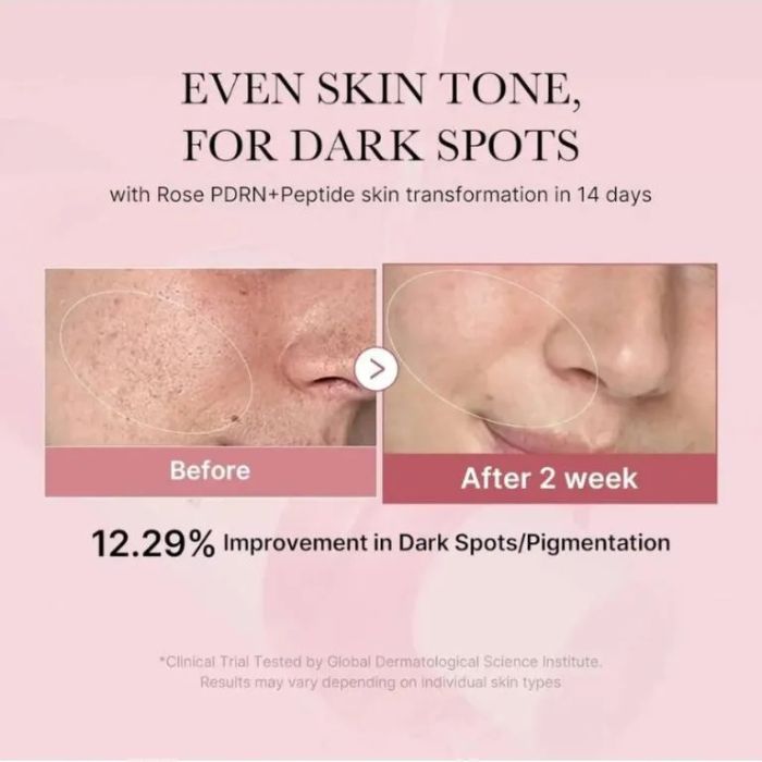 PDRN Pink Cica Soothing Toner – Καταπραϋντικό τόνερ προσώπου, 250ml
