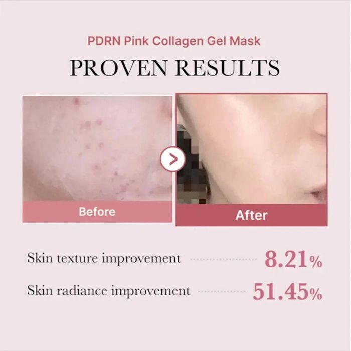 PDRN Pink Collagen Gel Mask – Μάσκα Gel με PDRN & κολλαγόνο για σύσφιξη και ενυδάτωση