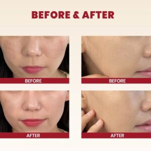 Seoul 1988 Cream : Snail Mucin 93% + Rice – Ενυδατική κρέμα με έκκριμα σαλιγκαριού, 100ml
