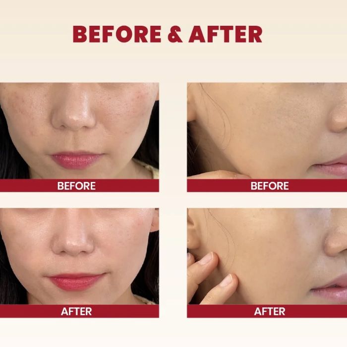 Seoul 1988 Cream : Snail Mucin 93% + Rice – Ενυδατική κρέμα με έκκριμα σαλιγκαριού, 100ml