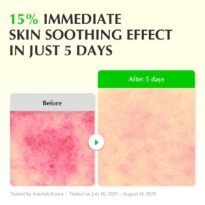 Aloe PDRN Calming Serum – Ορός άμεσης καταπράυνσης με Aloe PDRN & Ceramides, 30ml