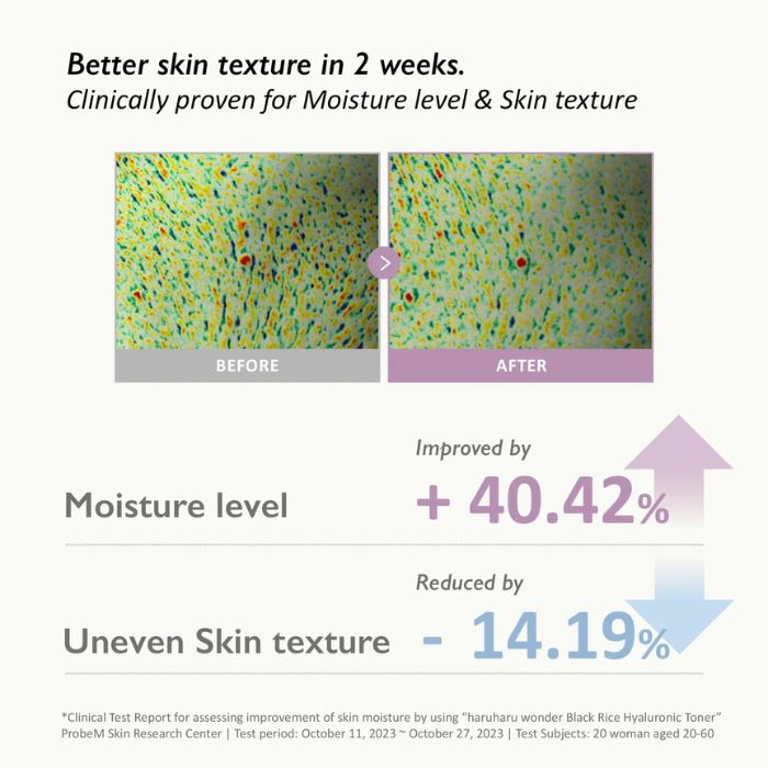 Black Rice Hyaluronic Toner For Sensitive Skin – Ενυδατικό τόνερ για ευαίσθητο δέρμα, 150ml