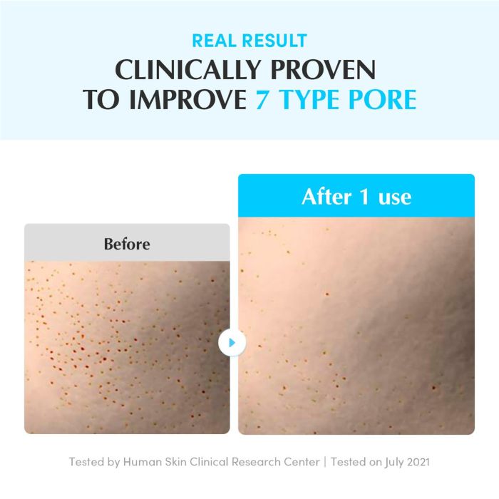 Hyaltoin Flooding Serum – Ορός εντατικής ενυδάτωσης 30ml
