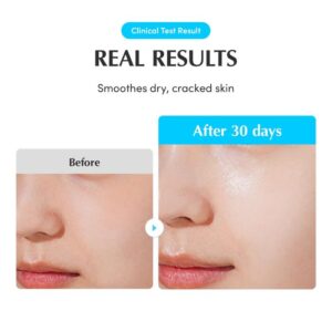 Hyaltoin Flooding Serum – Ορός εντατικής ενυδάτωσης 30ml