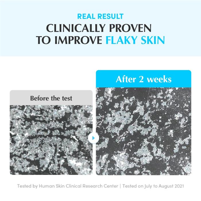 Hyaltoin Flooding Serum – Ορός εντατικής ενυδάτωσης 30ml