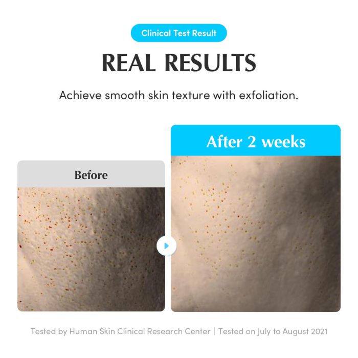 Hyaltoin Flooding Serum – Ορός εντατικής ενυδάτωσης 30ml