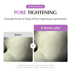 Purple PDRN Pore Minimizing Serum – Ορός για μείωση των πόρων, 30ml