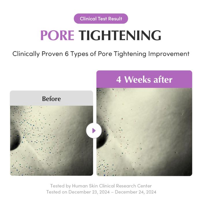 Purple PDRN Pore Minimizing Serum – Ορός για μείωση των πόρων, 30ml