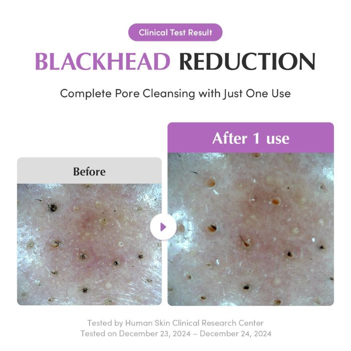 Purple Rice Pore Purifying Pack Cleanser – Καθαριστικό προσώπου & μάσκα αργίλου για λεία επιδερμίδα, 130gr