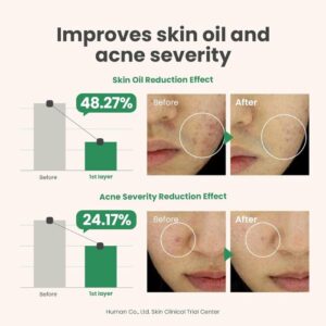 Spot The Difference Blemish Treatment – Serum Προσώπου με Centella Asiatica & AHA για ακμή, 15ml