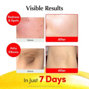 Vitamin Illuminating Serum – Ορός με βιταμίνη C για λάμψη και ομοιόμορφο τόνο, 30ml