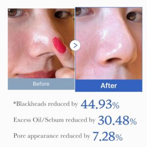 Zero Pore Pad – Απολεπιστικά δισκία για λείο δέρμα, 70τεμ.