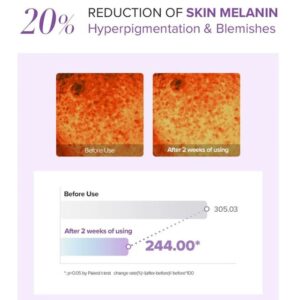 Tranexamic Acid+ Glutathione Eye Cream mini – Κρέμα ματιών για μαύρους κύκλους, 12ml