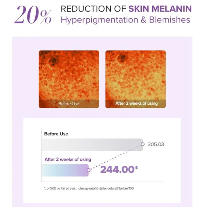 Tranexamic Acid+ Glutathione Eye Cream mini – Κρέμα ματιών για μαύρους κύκλους, 12ml