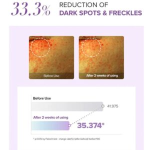 Tranexamic Acid+ Glutathione Eye Cream mini – Κρέμα ματιών για μαύρους κύκλους, 12ml