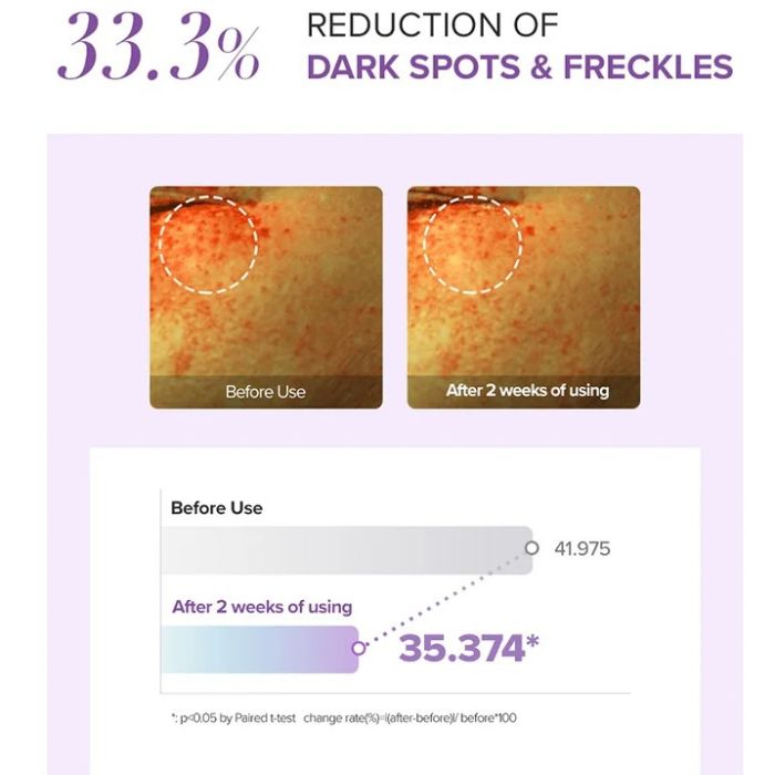 Tranexamic Acid+ Glutathione Eye Cream mini – Κρέμα ματιών για μαύρους κύκλους, 12ml