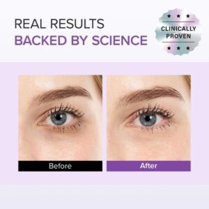 Tranexamic Acid+ Glutathione Eye Cream mini – Κρέμα ματιών για μαύρους κύκλους, 12ml