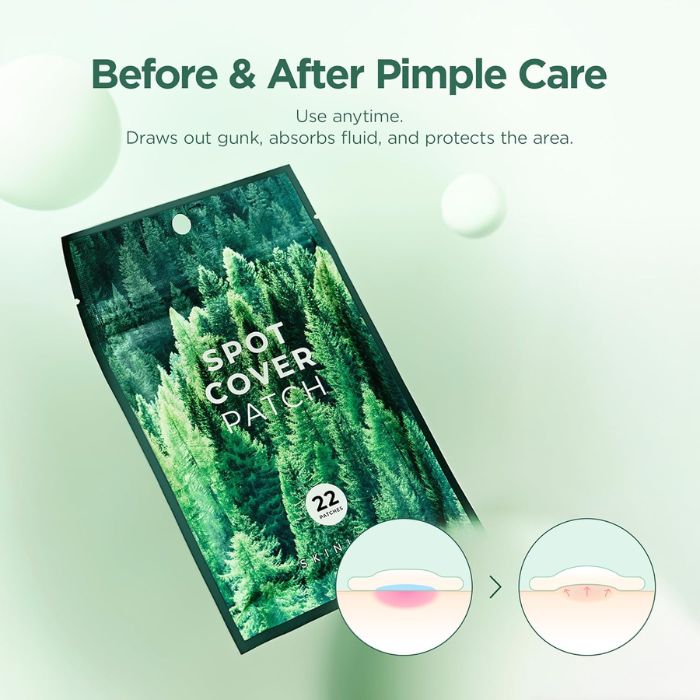 Madagascar Centella Tea-Trica Spot Cover Patch – Επιθέματα για επούλωση ακμής, 22τεμ
