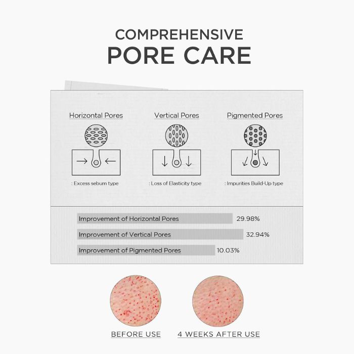 Niacinamide 10 Boosting Shot Ampoule – Ενισχυμένη αμπούλα για πόρους & λάμψη, 30ml