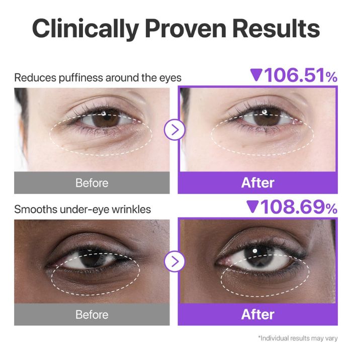 No.9 NAD Collagen Under Eye Patches – Eye patches με κολλαγόνο & 50 πεπτίδια, 1τεμ.