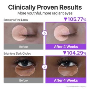 No.9 NAD Retinol Volumetox Eye Cream – Συσφιγκτική κρέμα ματιών με NAD+ & ρετινόλη για λεία, ξεκούραστη όψη, 10ml