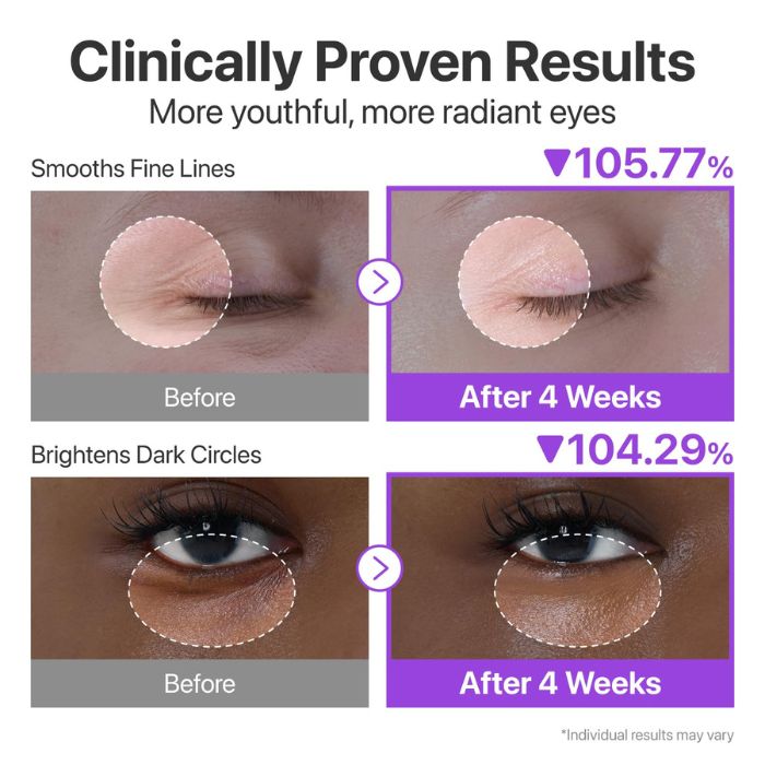 No.9 NAD Retinol Volumetox Eye Cream – Συσφιγκτική κρέμα ματιών με NAD+ & ρετινόλη για λεία, ξεκούραστη όψη, 10ml