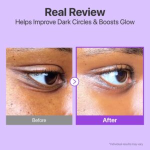 No.9 NAD Retinol Volumetox Eye Cream – Συσφιγκτική κρέμα ματιών με NAD+ & ρετινόλη για λεία, ξεκούραστη όψη, 10ml