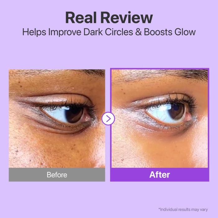 No.9 NAD Retinol Volumetox Eye Cream – Συσφιγκτική κρέμα ματιών με NAD+ & ρετινόλη για λεία, ξεκούραστη όψη, 10ml