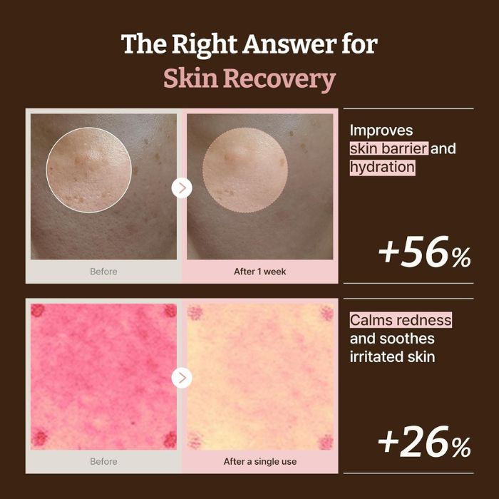 Advanced PDRN Rejuvenating Cream – Αντιγηραντική κρέμα νύχτας με PDRN, 20ml