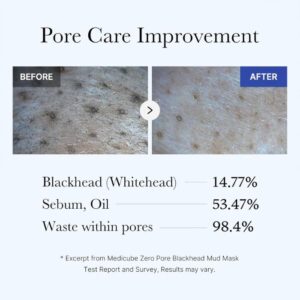 Zero Pore Blackhead Mud Mask – Μάσκα καθαρισμού και σύσφιξης πόρων με άργιλο, 100gr