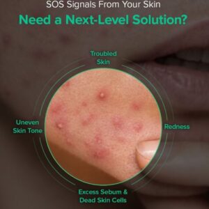 Mary & May Spicule Azelaic PDRN Spot Cream – Kρέμα για σημάδια ακμής με Αζελαϊκό οξύ και PDRN, 15ml