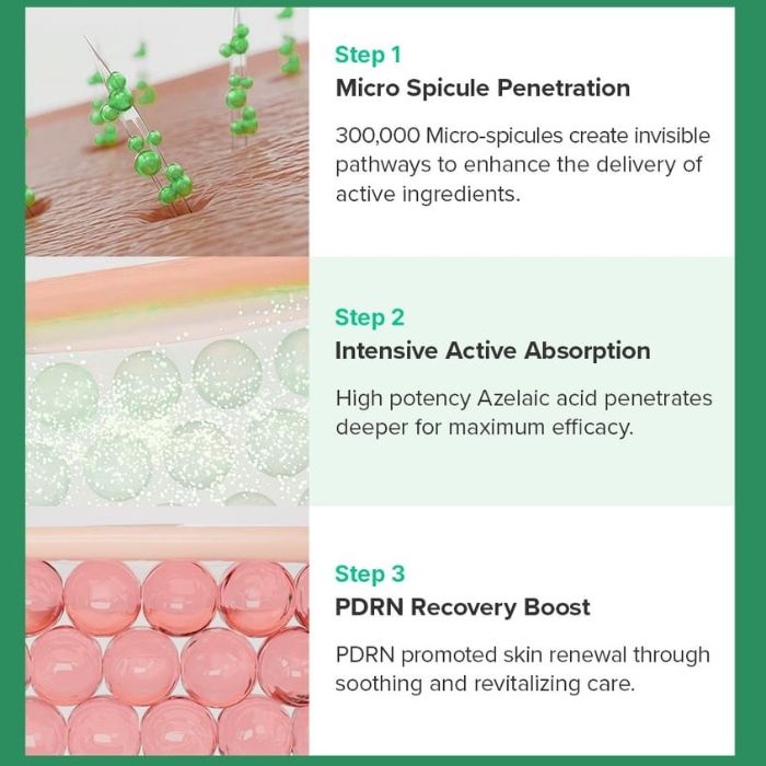 Mary & May Spicule Azelaic PDRN Spot Cream – Kρέμα για σημάδια ακμής με Αζελαϊκό οξύ και PDRN, 15ml