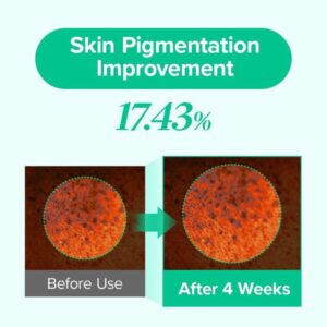 Mary & May Spicule Azelaic PDRN Spot Cream – Kρέμα για σημάδια ακμής με Αζελαϊκό οξύ και PDRN, 15ml
