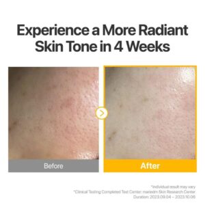 Numbuzin No.5 Vitamin Spotlight Sheet Mask – Συμπυκνωμένη βιταμινούχα υφασμάτινη μάσκα προσώπου με γλουταθειόνη, 1τεμ.