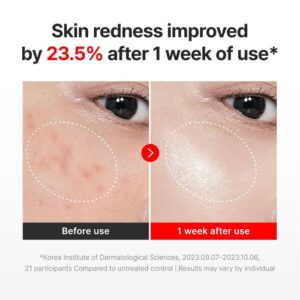 Centellian24 Madeca Cream Time Reverse – Αντιγηραντική κρέμα ολικής επανόρθωσης, 15ml